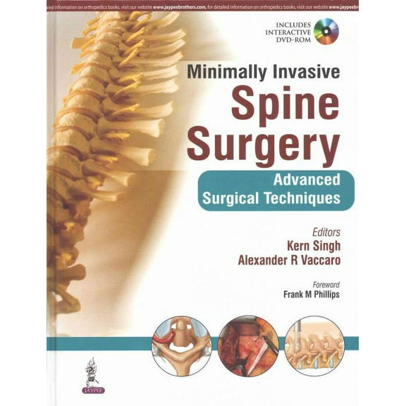 Minimally Invasive Spine Surgery