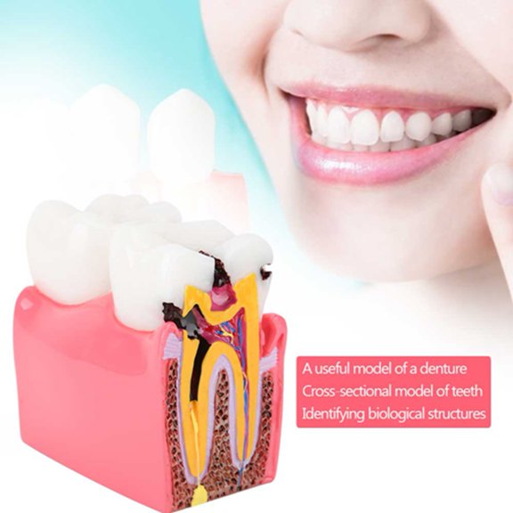 Mioren Teeth Model Anatomy Model, Resin Teeth Model for Oral Care for Laboratory
