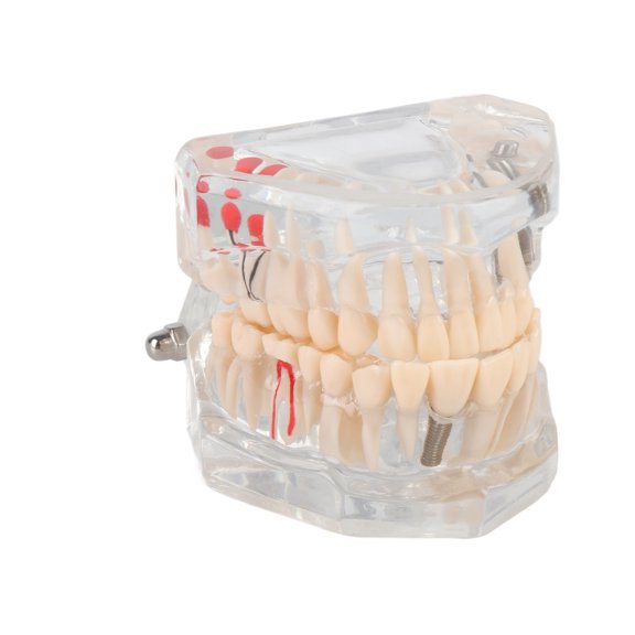 Mioren Tooth Model Tooth Model, High Durability Tooth Education Model for Home for School