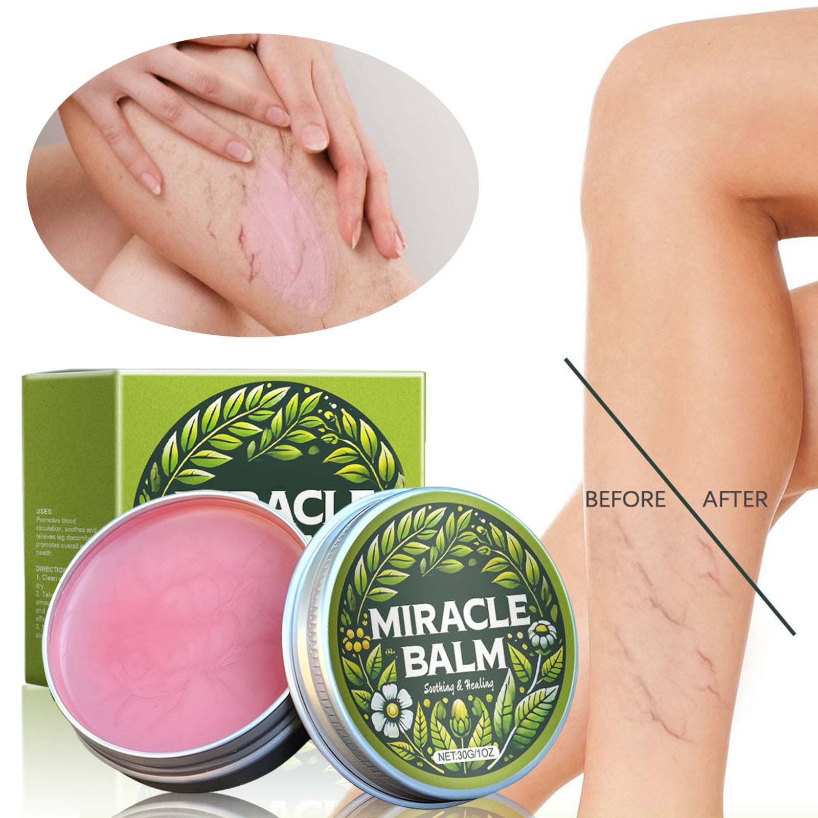 Miracle Balm, Miracle Balm for Edema, Soothing Joint Cream for Back ...