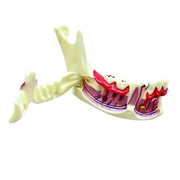Misright Jaw Bone Anatomy Model With Detachable Gingival For Dental Clinics Training