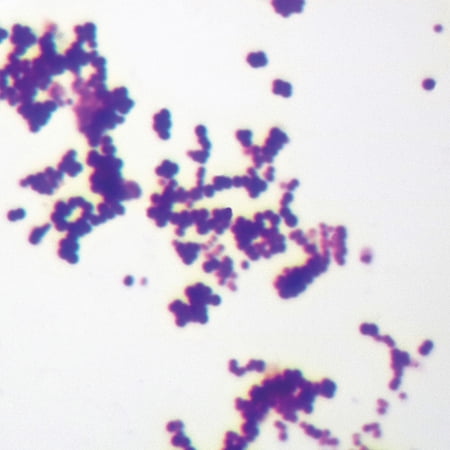 Mixed Gram-Positive & Gram-Negative Coccus, W.M. Gram Stain Microscope Slide
