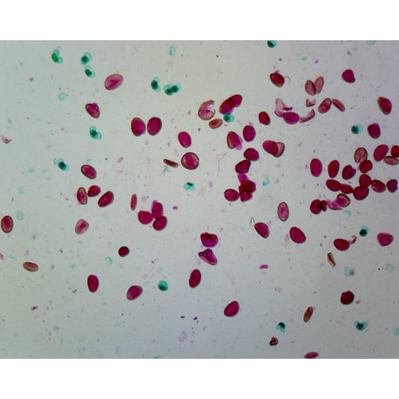 Mixed Pollen Comparison; Typical Dicot Pollens; Whole-mount by Go Science Crazy