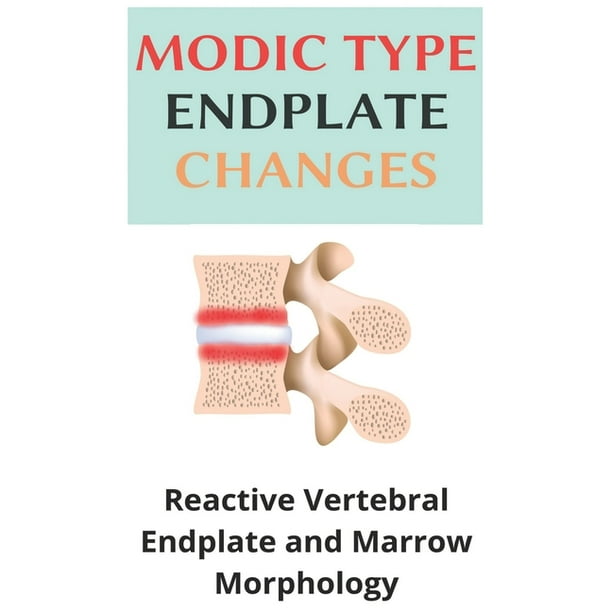 Modic Type Endplate Changes Reactive Vertebral Endplate And Marrow Morphology What Causes