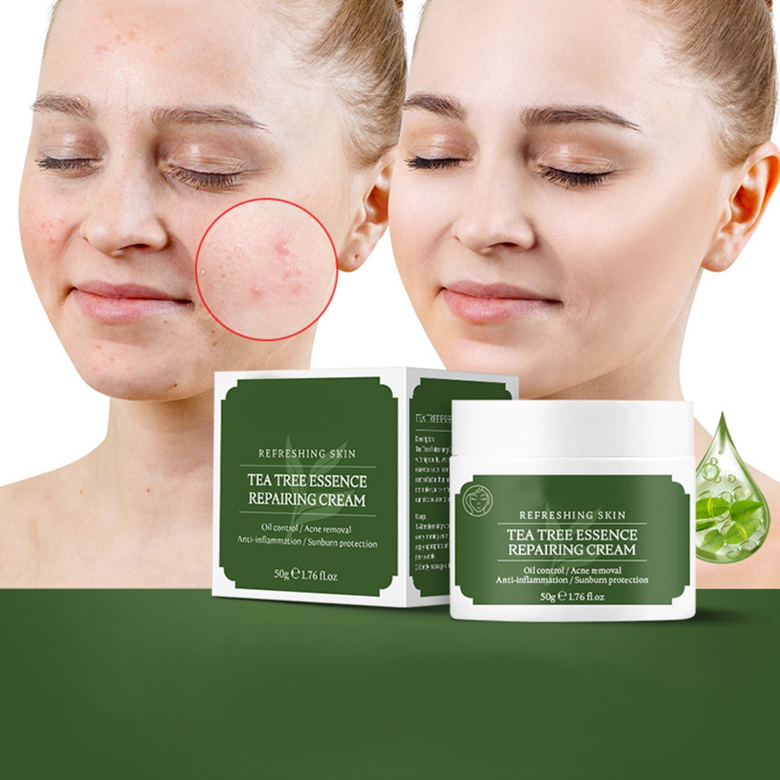 Moisturizer Face Cream Tea Trees Essences Creams Print Oil Control