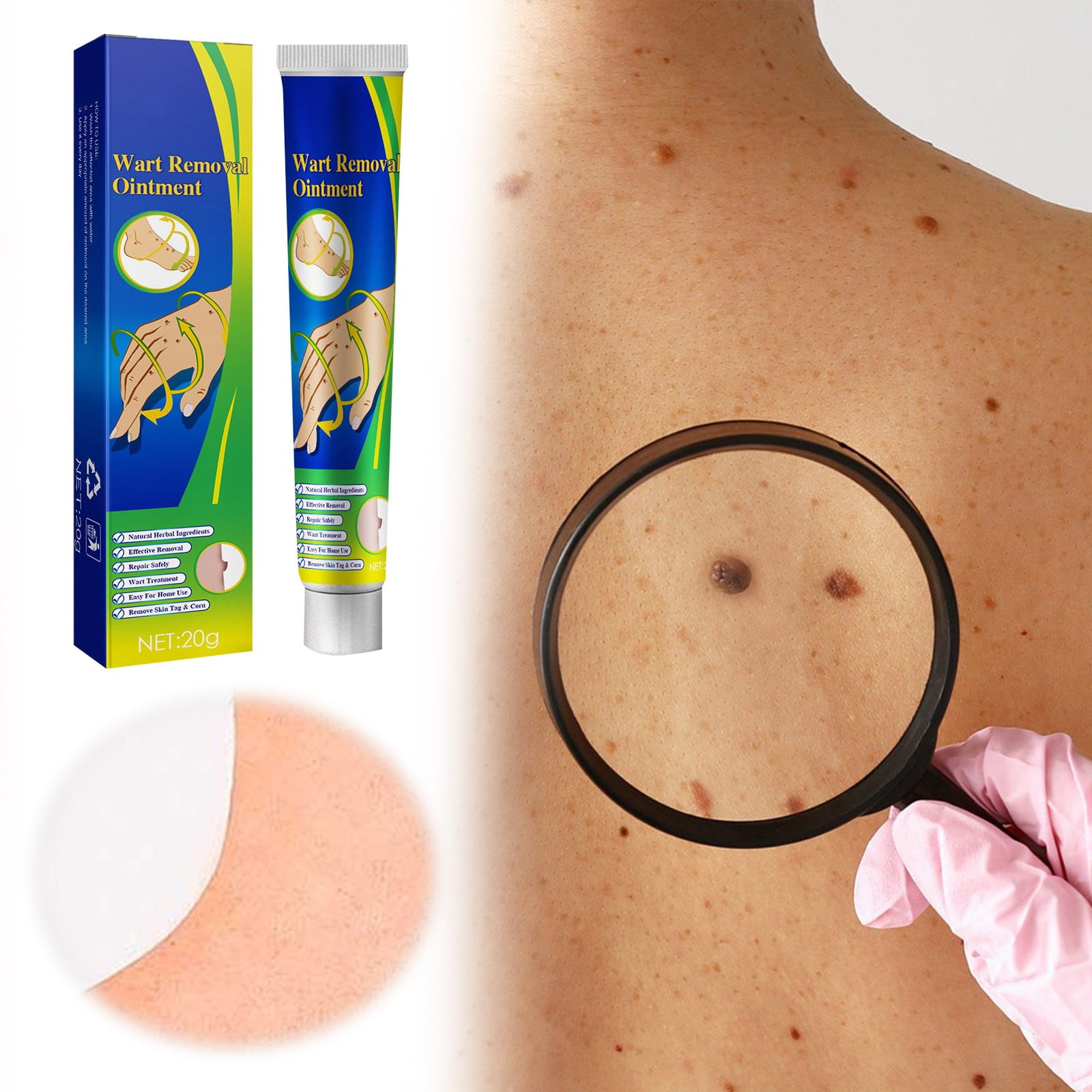 Moisturizing and Hydrating Skin Ke Wart Wart Chicken Eye Ointment Ke