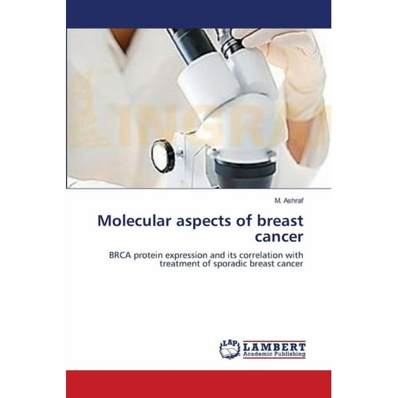 Molecular aspects of breast cancer (Paperback)