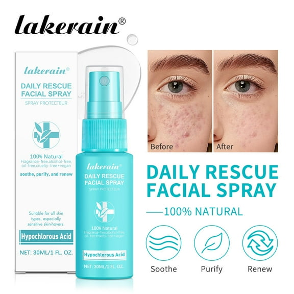 Momihoom Daily Rescue Facial Spray,Face Mist, Moisture Boost Facial Spray , Hydrating & Moisturizing Skin Care for Dry and Dehydrated Skin