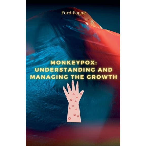 Monkeypox: Understanding And Managing The Growth, (Paperback)