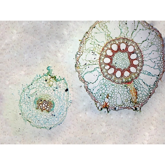 Monocot and Dicot Root Comparison; Cross Section; QS Stain by Go Science Crazy