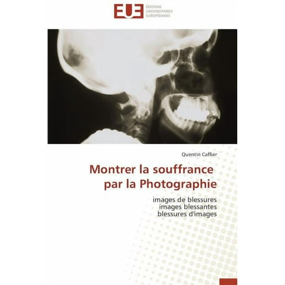 Montrer la souffrance par la Photographie