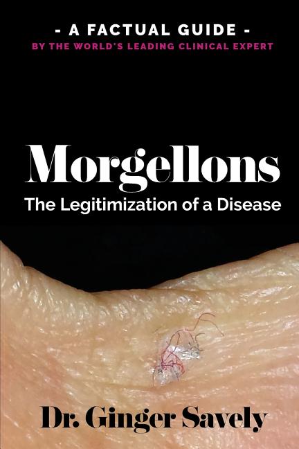 Morgellons : The Legitimization of a Disease: A Factual Guide by the World's Leading Clinical Expert - image 1 of 1