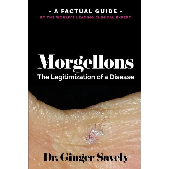 Morgellons : The Legitimization of a Disease: A Factual Guide by the World's Leading Clinical Expert