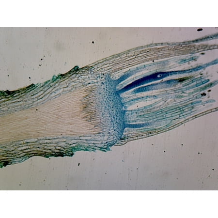 Moss Antheridia; Longitudinal Section by Go Science Crazy