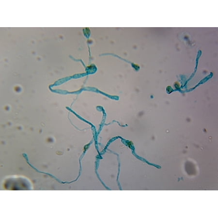 Moss Protonema; Whole-mount