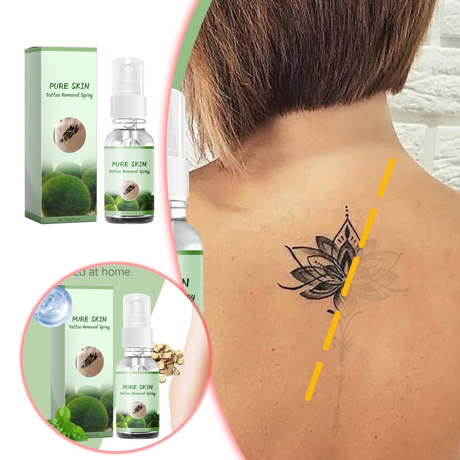 Most Popular 30ml Cleaning Spray And Moisturizing Body Skin Fade Mark