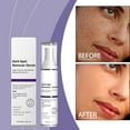 Most Popular Facial Brightens Skin Reduces Dark Improves Skin