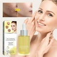 Most Popular Oil For Removal Extract Oil Scar Cells Shiny Smooth Skin