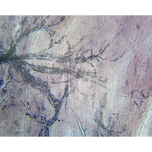 Motor Nerve Endings and Plates, Mammalian; Whole-mount by Go Science Crazy