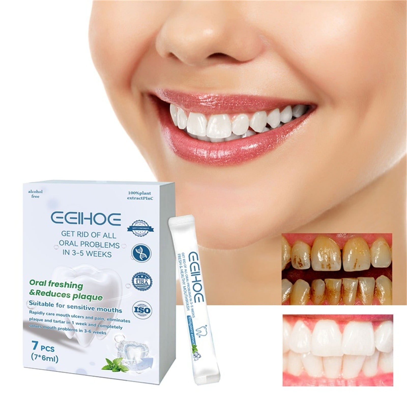 Mouthwash, Antiseptic, Bad Breath Plaque & Gingivitis Protection