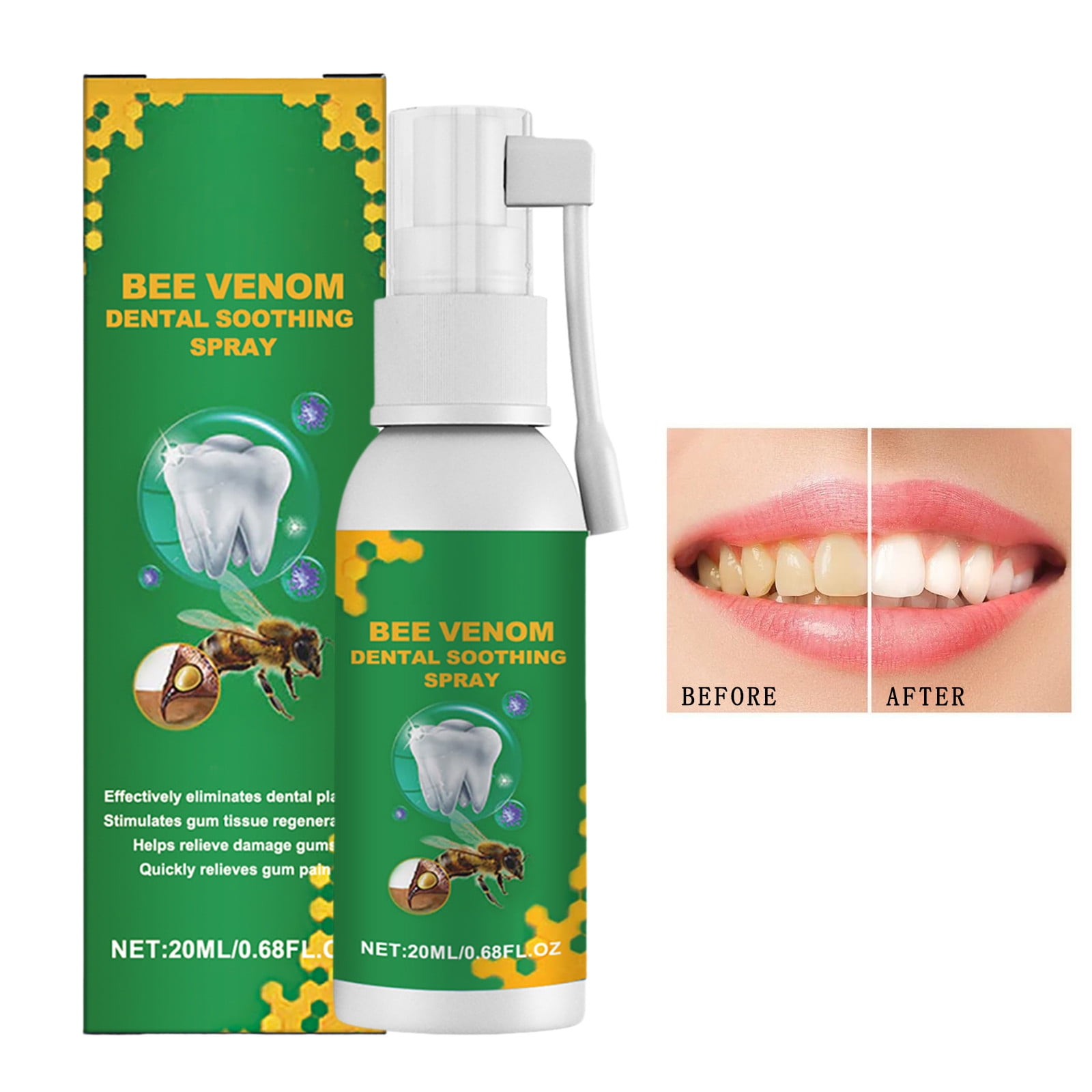 Mouthwash Oral health Teeth cleaning Gum Spray Quickly Gum Swelling And
