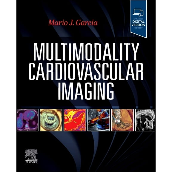 Multimodality Cardiovascular Imaging, (Paperback)
