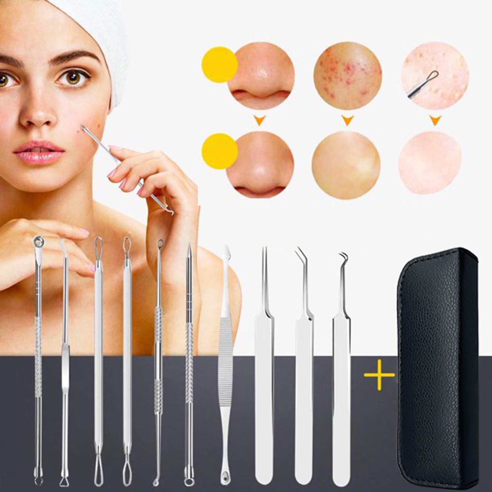 Musatteng Face Wash 10 Pcs Blackhead Remover Pimple Tool