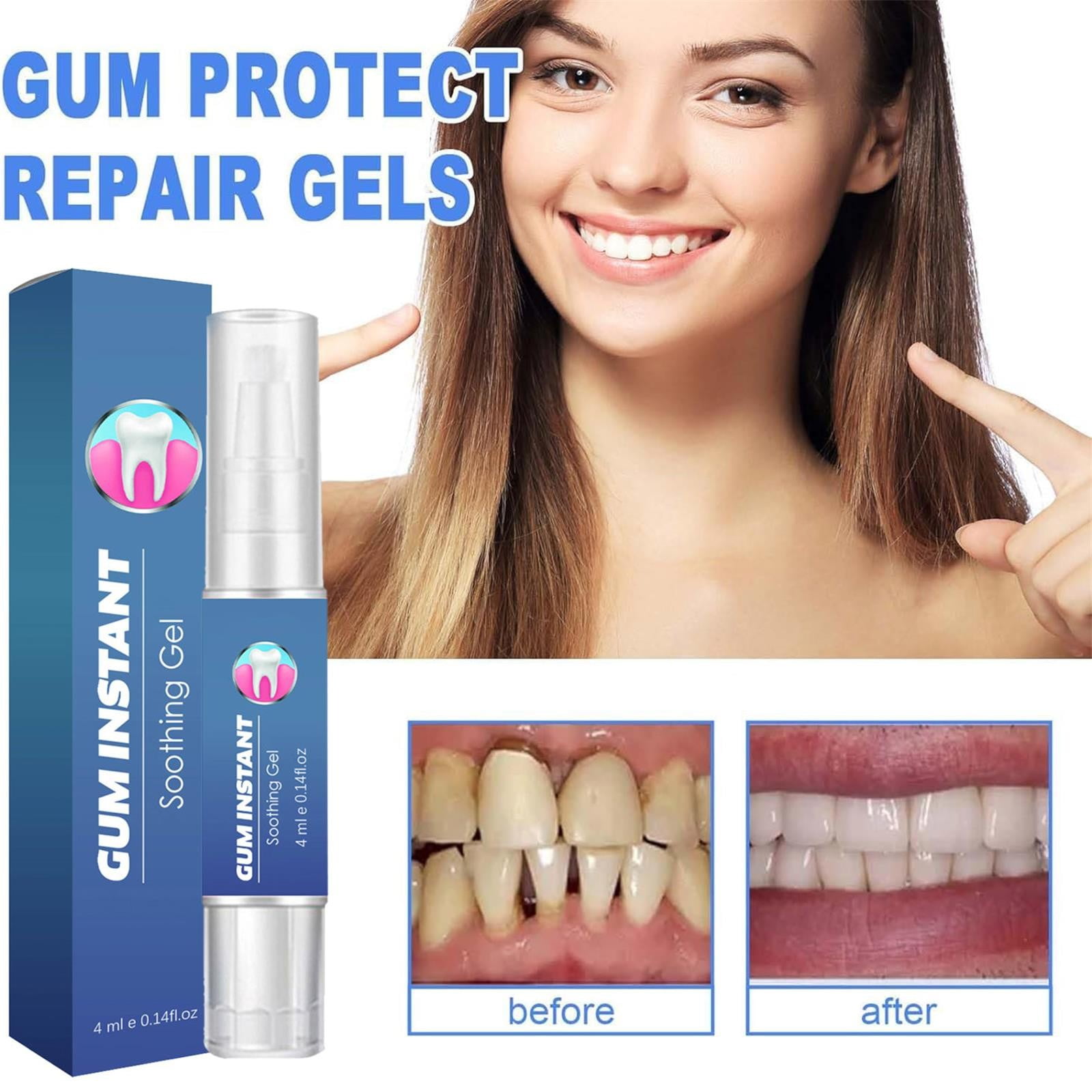 Musatteng Spotlight Teeth ning Gingival Care Gel Swelling And Of