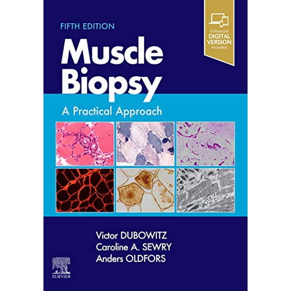 Pre-Owned Muscle Biopsy: A Practical Approach [Hardcover] Dubowitz MD PhD FRCP FRCPCH, Victor; Sewry BSc PhD FRCPath, Caroline A. and Oldfors MD PhD, Anders