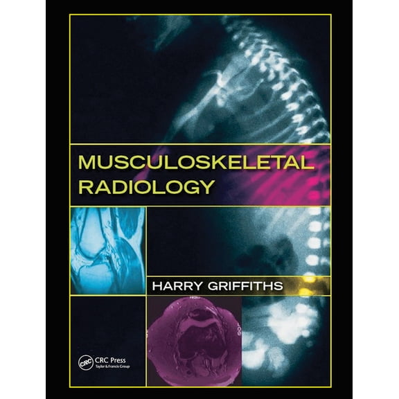Musculoskeletal Radiology, (Paperback)