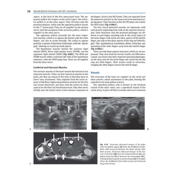 Pre-Owned Musculoskeletal Ultrasound with MRI Correlations (Hardcover) by Vikram S Dogra, Diana Gaitini