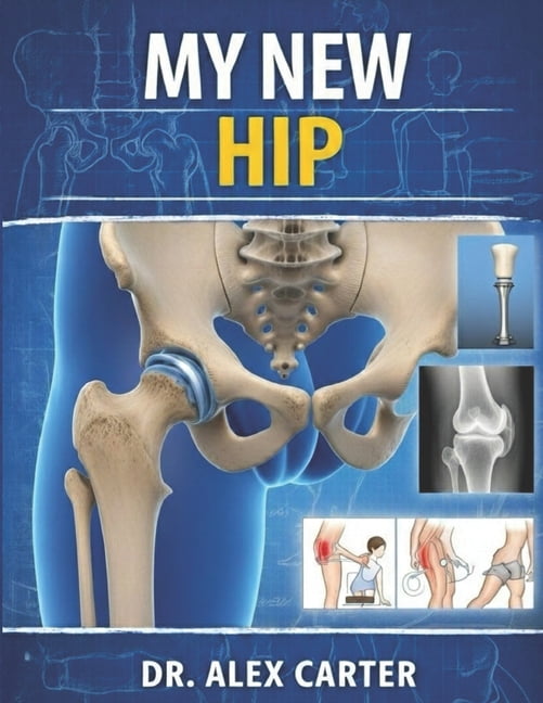 My New Hip: The Complete Guide to Hip Replacement Surgery, Recovery ...