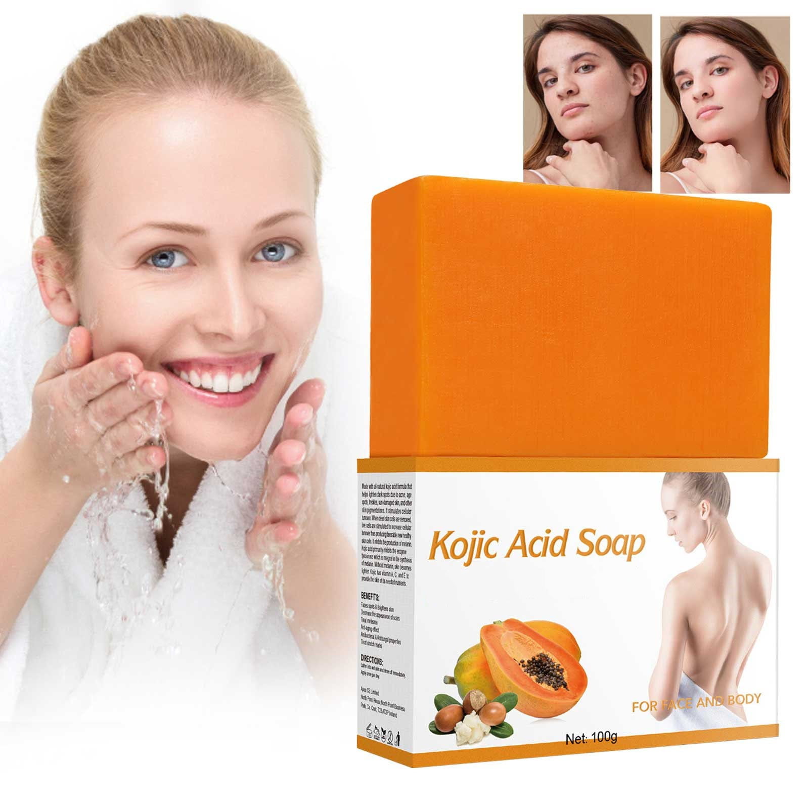 My Orders Skin Soap The Soap With And Moisturizing Properties Even Skin ...