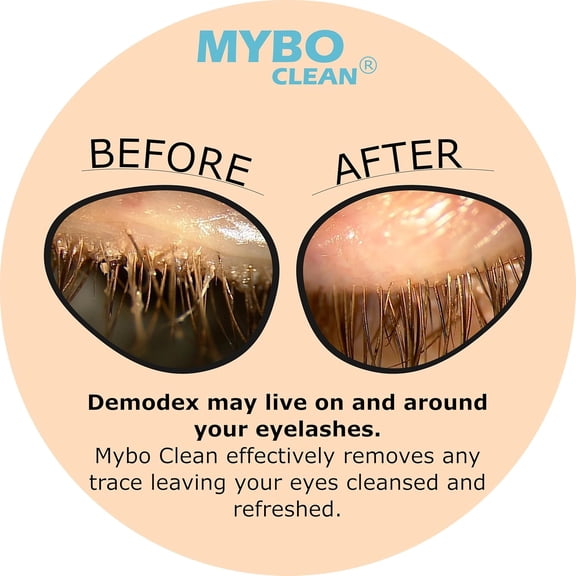 Mybo Clean Eyelid Cleansing Brush for Sensitive Skin (1 Pc) + Hydrating Lids and Lash Cleansing Gel (1Pc) + Travel Bag