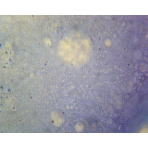 Mycobacterium Tuberculosis; Smear; Gram-Positive by Go Science Crazy