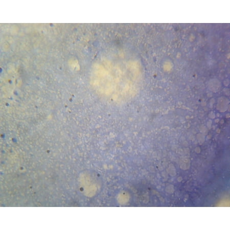 Mycobacterium Tuberculosis; Smear; Gram-Positive by Go Science Crazy