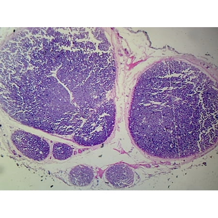 Myelinated Peripheral Nerve, Human; Cross Section by Go Science Crazy