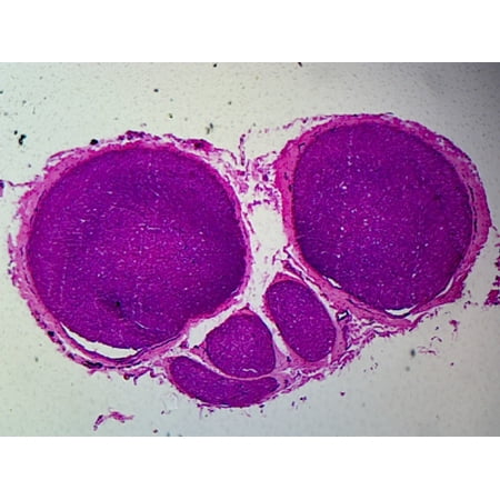 Myelinated Peripheral Nerve, Mammalian; Cross Section by Go Science Crazy