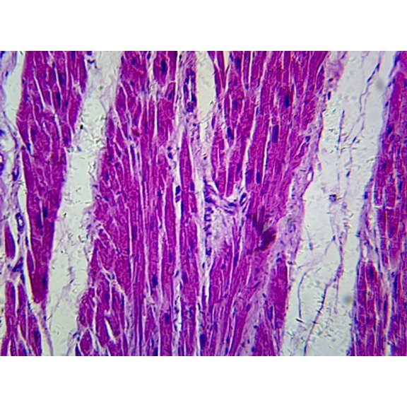 Myocardial Infarction; Section; H&E Stain; Showing Damaged Muscle by Go Science Crazy