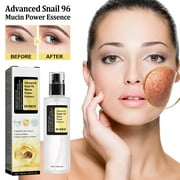 NATUREASY Snail Mucin 96% Power Repairing Essence 3.38 fl.oz 100ml, Hydrating Serum for Face with Snail Secretion Filtrate for Dull Skin & Fine Lines, Advanced Skincare, 1PC