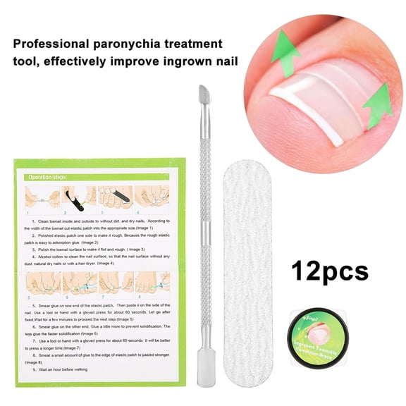NFTIGB 12 Pcs Professional Nail Correction Sticker Set Pedicure Paronychia Recover Tool Flexible Ingrown Toe Nail Care Kit With File And Pusher 0.16 inches / 4 mm