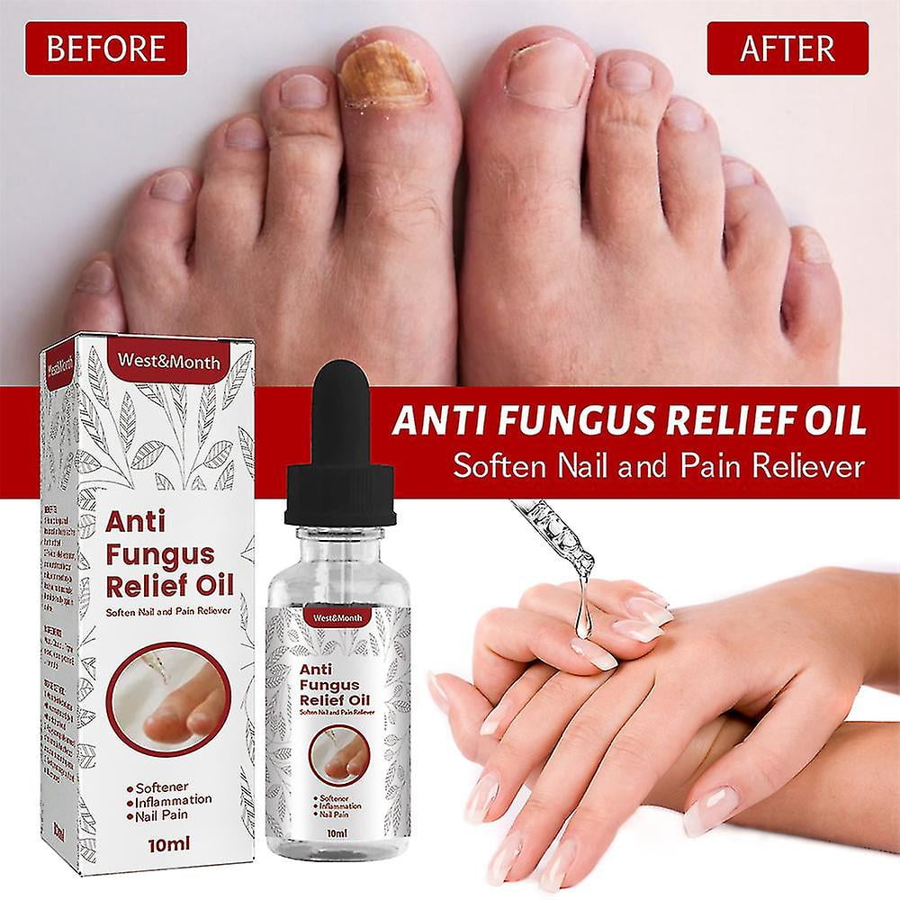 Nail Fungus Oil Hand Foot Repair Serum Against Toenail Fungus Anti