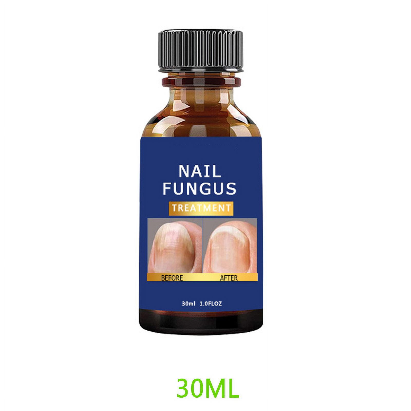 Nail Fungus Treatment for Toenail, Extra Strength Effective Fingernail ...
