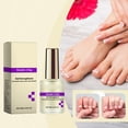 thumbnail image 1 of Nail Hardener Nail Strengthener Instant Gloss Keratin Nail Treatment Fast Dry Clear Finish Manicure Care for Thin Weak Nails Daily Use Long Lasting Shine Top Coat, 1 of 9