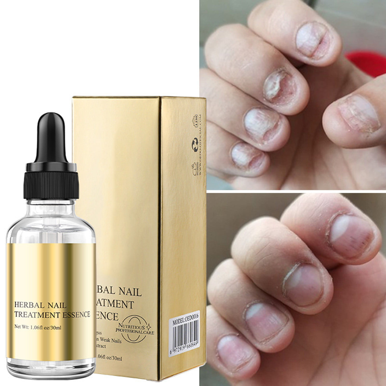 Nail Nourishing Fingernail Nail Kit Nail Oil For Nail Smoother Be Water