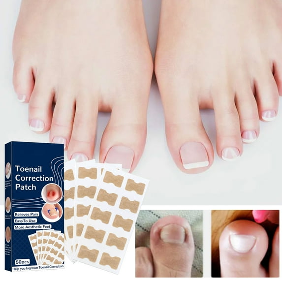 Nail Patches,Ingrown Toenail Correction Treatment Tool, No Glue 50Pcs Ingrown Toe nail Corrector Patch, Professional Ingrown Toenail Sticker