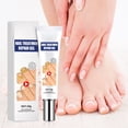 thumbnail image 1 of Nail Repair Cream for Soft Nails, Ingrown Toenail Treatment for Hands and Feet, Brightening Nail Care Solution, 20g Tube, 1 of 6