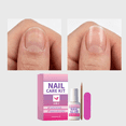 thumbnail image 1 of Nail Repair Kit – Fix Broken or Damaged Nails with Silk Wrap, Glue & File – Nail Repair Kit For Broken Natural Nails - Video & Written Instructions Included, 1 of 5