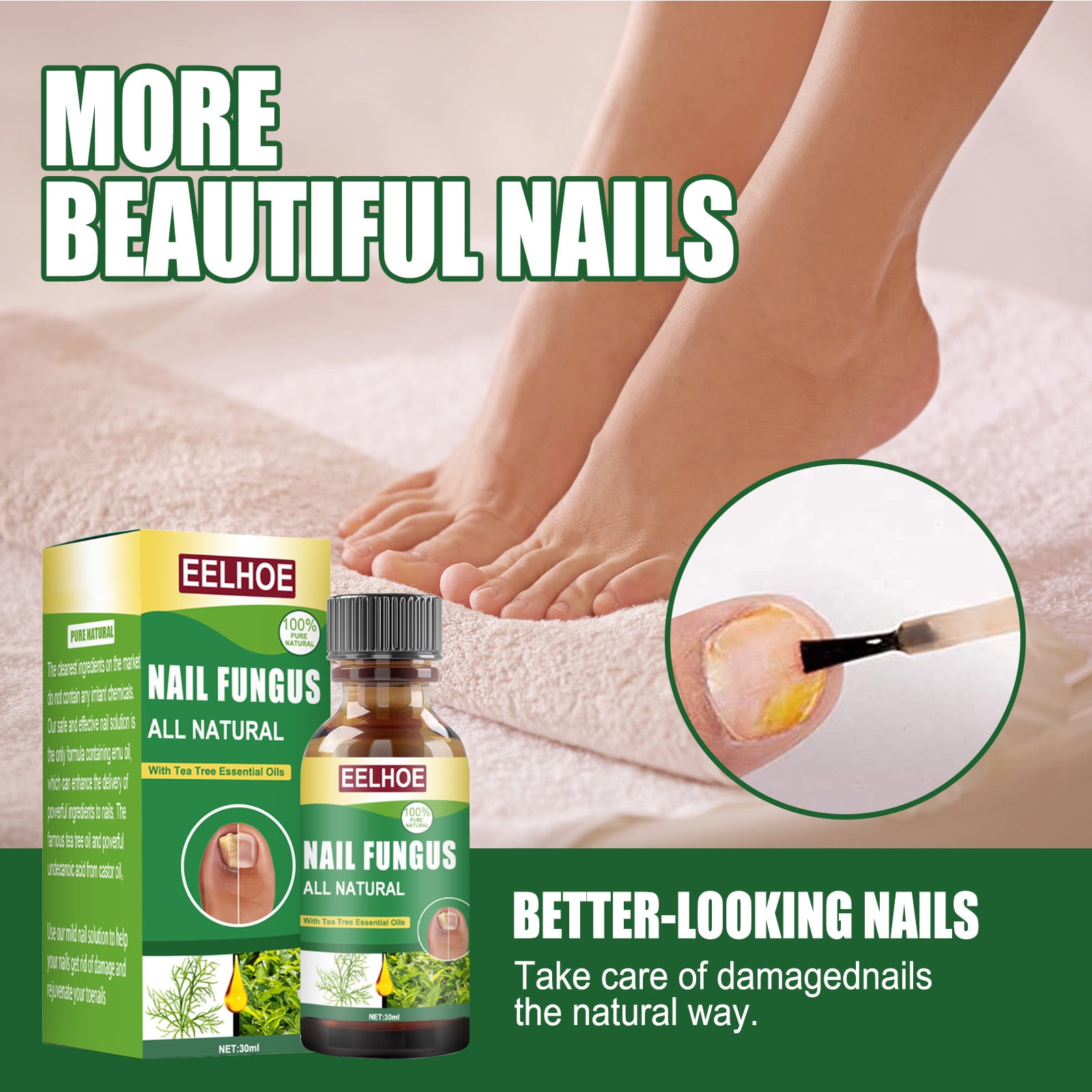 Kerasal Nail Fungal Nail Renewal Treatment for Discolored or Damaged Nails,  10ml (0.33oz) - Walmart.com