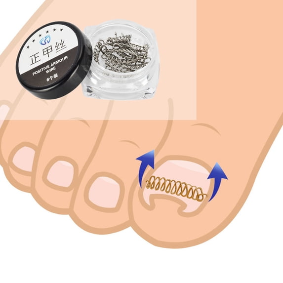 Nail Tools Toe Correction Fixer Tool Set Pedicure Paronychia Wire Recovery 6 Pairs for Nail and